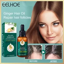 Eelhoe Ginger Hair Follocle Repairing Essential Oil