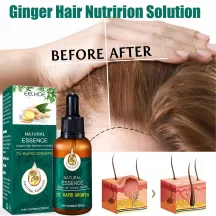 Eelhoe Ginger Hair Follocle Repairing Essential Oil