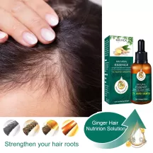 Eelhoe Ginger Hair Follocle Repairing Essential Oil