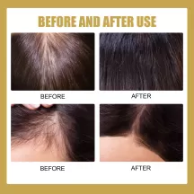 Eelhoe Hair Growth Shampoo Powder