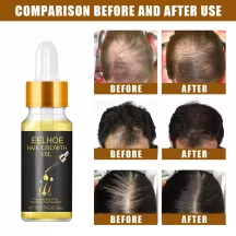 Eelhoe Hair Growth Oil Liquid