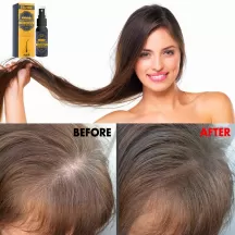 Eelhoe Hair Growth Castor Oil Spray