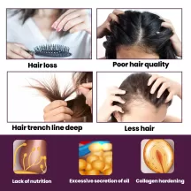 Eelhoe Hair Nutrition Growth Foam