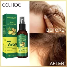 Eelhoe Ginger Growth Spary For Hair