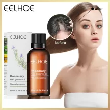 Eelhoe Rosemary Essential Oil For Hair Growth