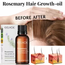 Eelhoe Rosemary Essential Oil For Hair Growth