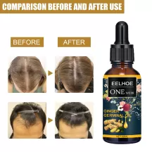 Eelhoe Hair Ginger Oil