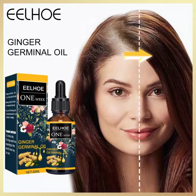 Eelhoe Hair Ginger Oil