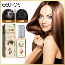 Eelhoe Hair Growth Essential Oil