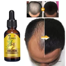 Eelhoe Ginger Hair Growth Oil