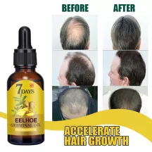 Eelhoe Ginger Hair Growth Oil