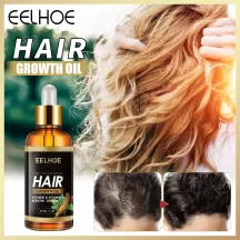 Eelhoe Hair Growth Oil