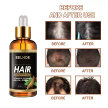 Eelhoe Hair Growth Oil