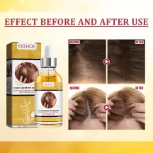 Eelhoe Hair Growth Serum Fluid