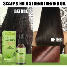 Eelhoe Hair Stren Gthening Oil