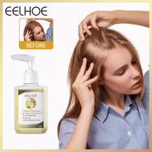 Eelhoe Ginger Shampoo For Hair