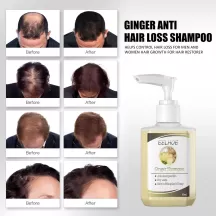 Eelhoe Ginger Shampoo For Hair