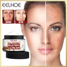 Eelhoe Freckle Removal Cream - Whitening